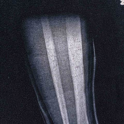 Foo Fighters Broken Leg 2015 T-Shirt